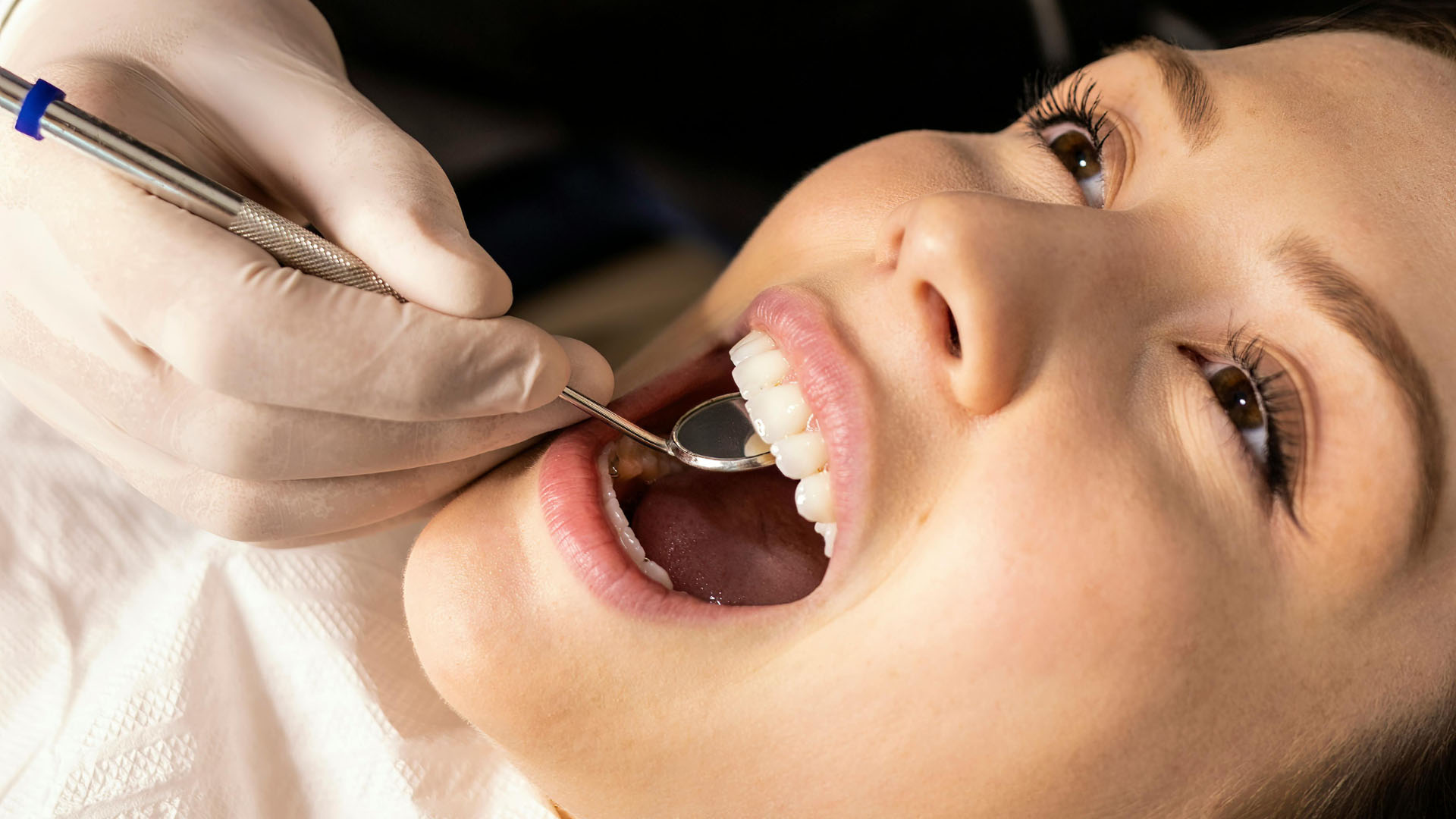 Close-up of a dentist using a mouth mirror and probe to examine a young woman's teeth during a dental check-up